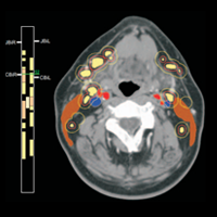 Image for Lift Chart Widget