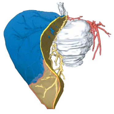 Image for Virtual Resection